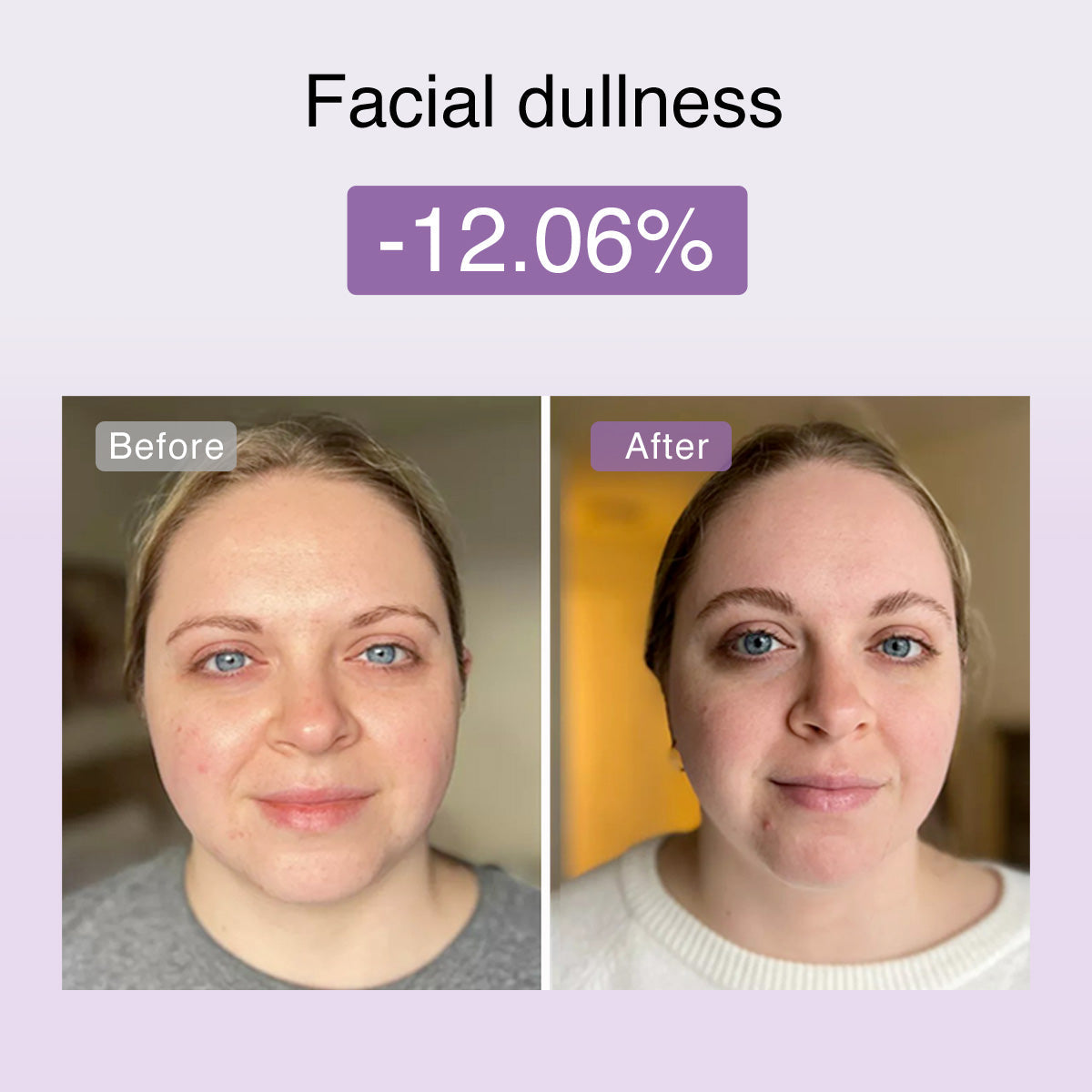 Fusionglow Multi-Functional Microcurrent Facial Toning Device