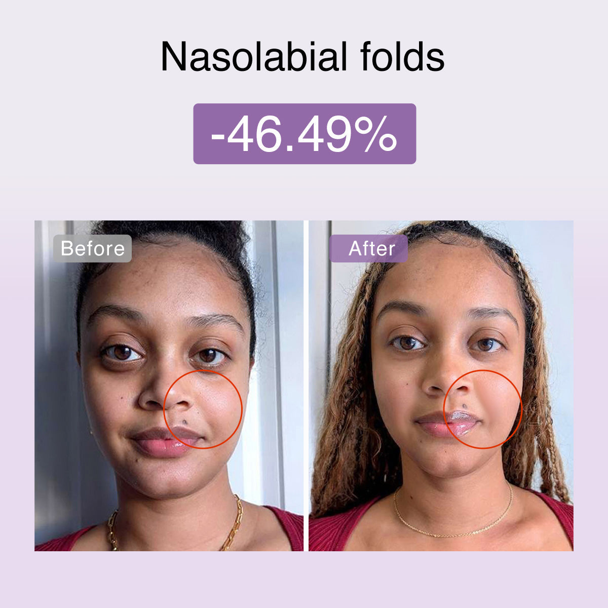 Fusionglow Multi-Functional Microcurrent Facial Toning Device