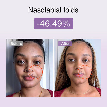 Fusionglow Multi-Functional Microcurrent Facial Toning Device