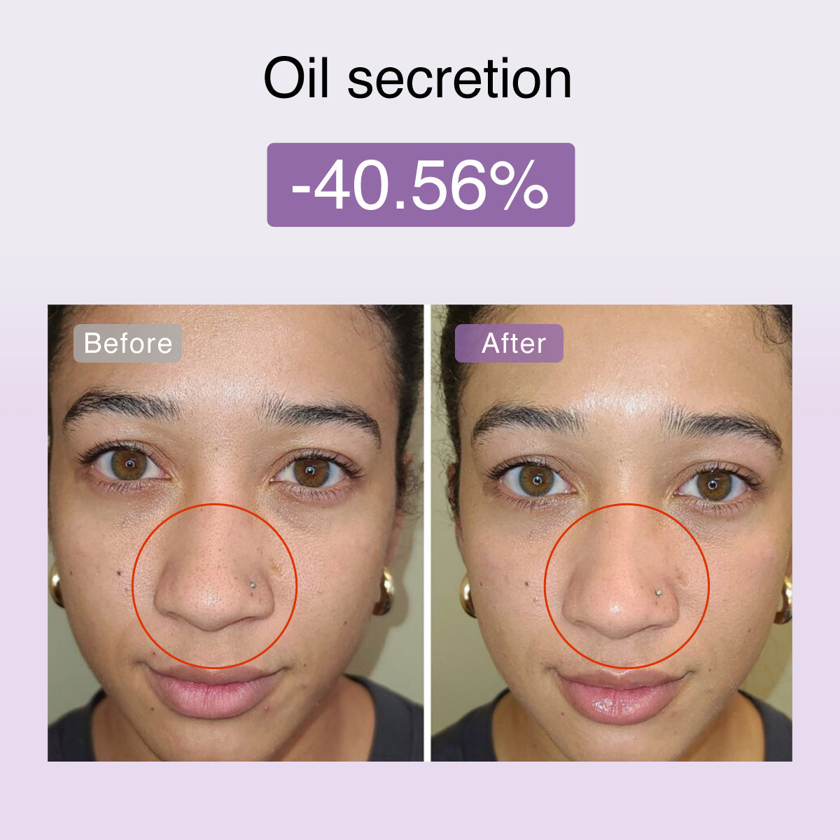 Fusionglow Multi-Functional Microcurrent Facial Toning Device