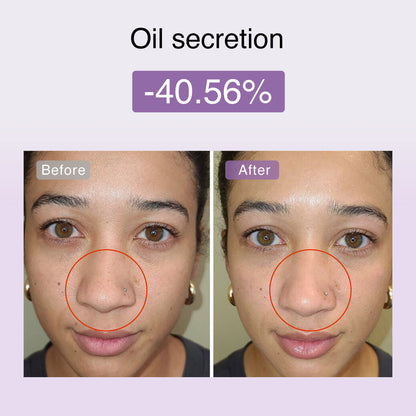 Fusionglow Multi-Functional Microcurrent Facial Toning Device