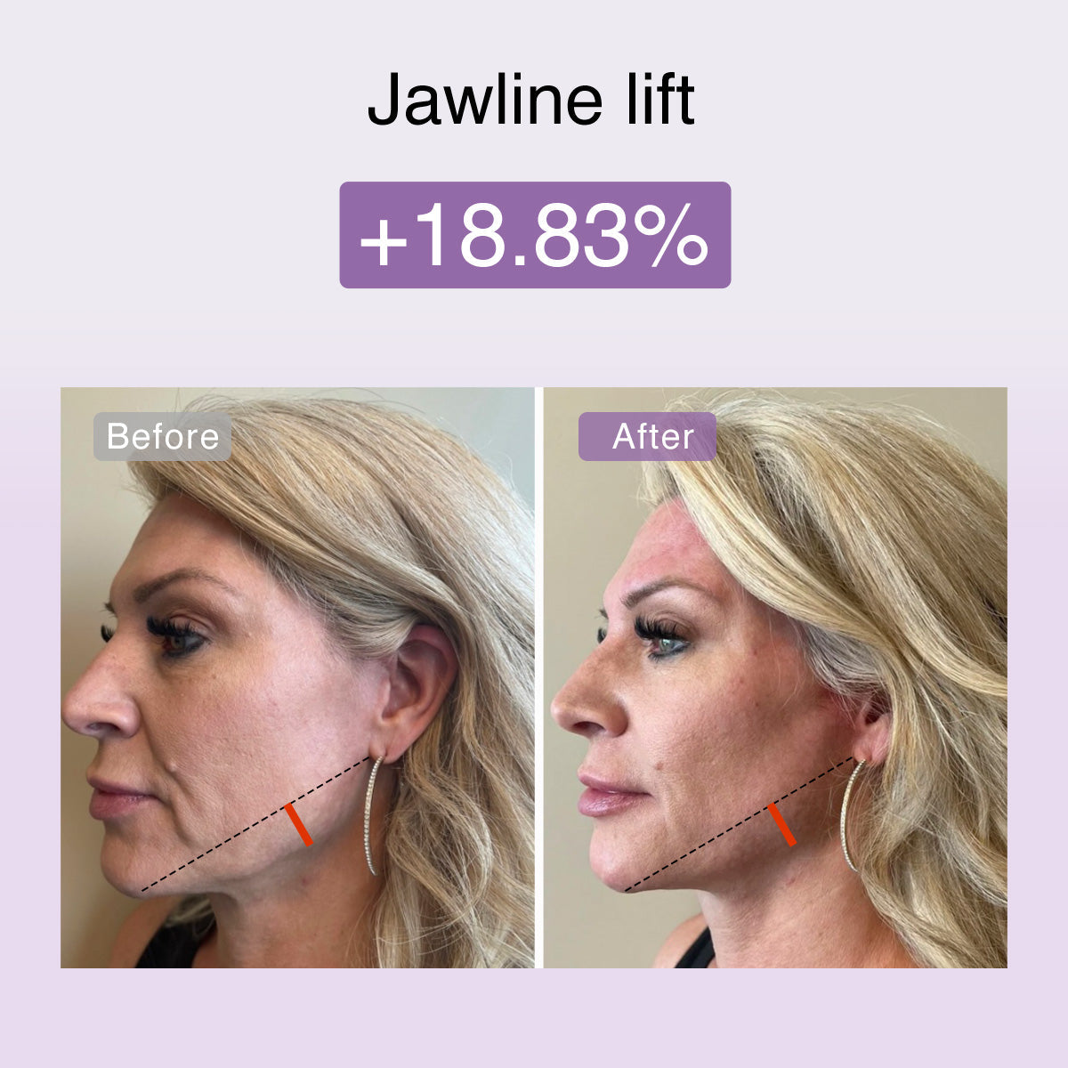 Fusionglow Multi-Functional Microcurrent Facial Toning Device